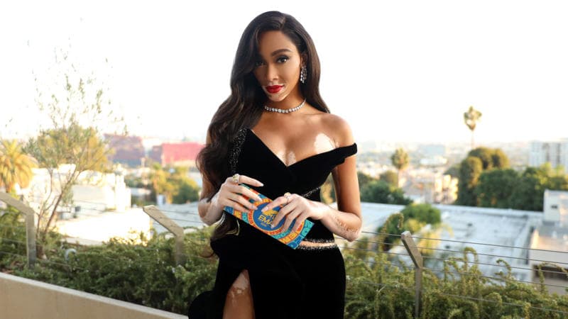 Winnie Harlow Joins Few Black Female Founders Who've Raised Over $1M In Funding After $4.1M Seed Round For Her Skincare Line Winnie Harlow Joins Few Black Female Founders Who've Raised Over $1M In Funding After $4.1M Seed Round For Her Skincare Line